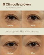 Crema Contorno de Ojos Ever-Youth Dual Effect Nine Less - Imagen 2